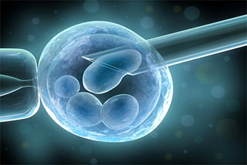 体外受精 IVF-ET